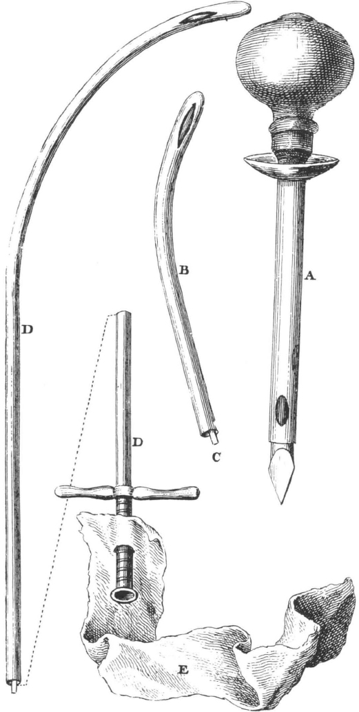 Surgery in Massachusetts, 1620–1800 - Colonial Society of Massachusetts